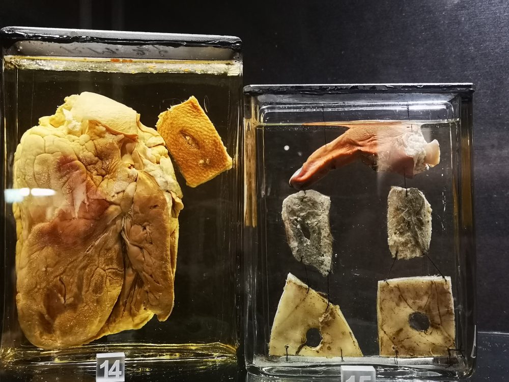 lappeteppet-teknisk-museum-hull-i-hjertet-skudd-i-hodet